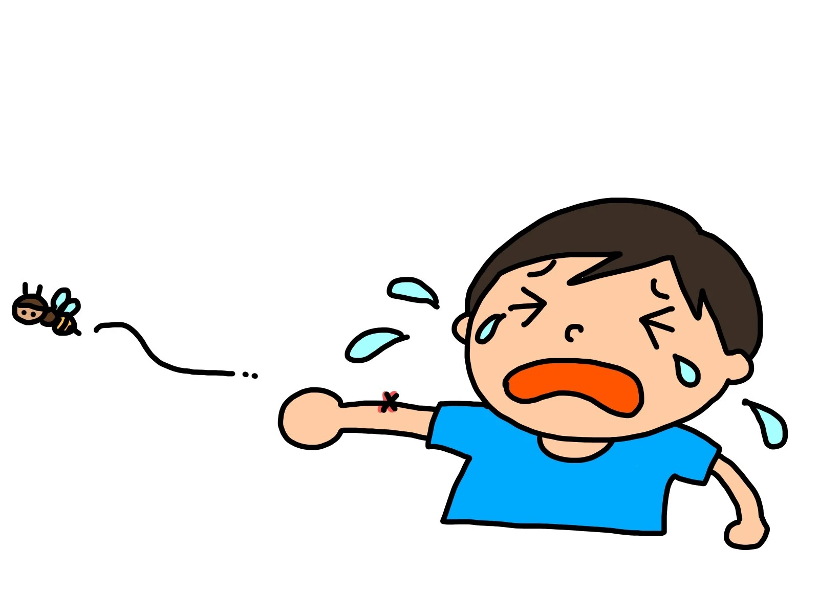 子供の腕を刺したクマバチの絵